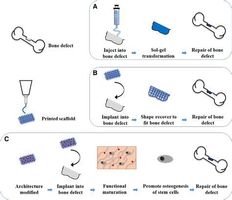 Applications of 4D printing in bone tissue engineering. (A) Injectable ...