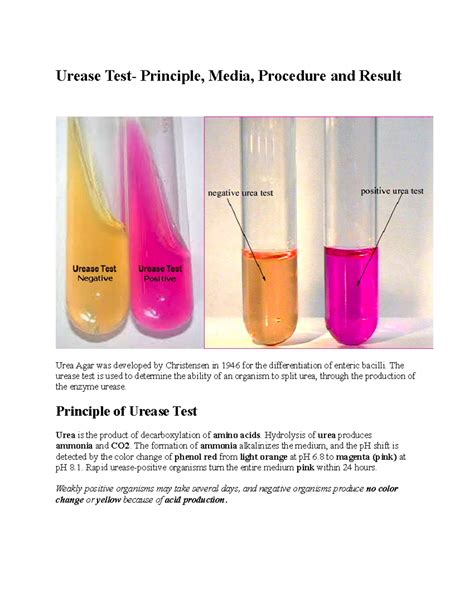 Urease Test - Lab - Urease Test- Principle, Media, Procedure and Result Urea Agar was developed ...