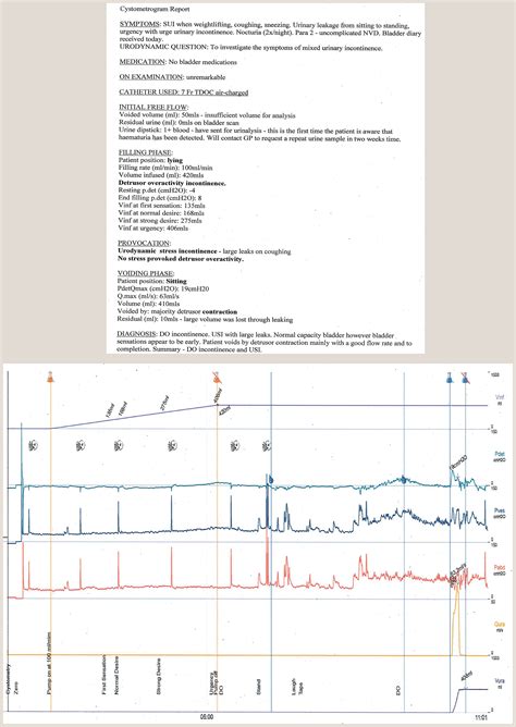 Basic understanding of urodynamics - Obstetrics, Gynaecology and Reproductive Medicine