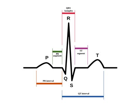 Ecg Interpretação Das Ondas