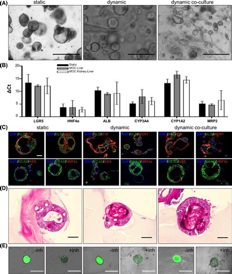 Characterization of liver organoids in static and dynamic (co‐)culture.... | Download Scientific ...