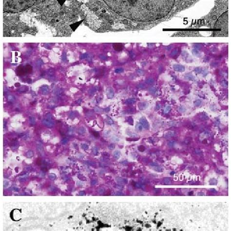 Detection of glycogen granules. (A) Transmission electron micrographs... | Download Scientific ...