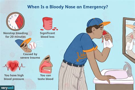 How To Stop Nose Bleeding