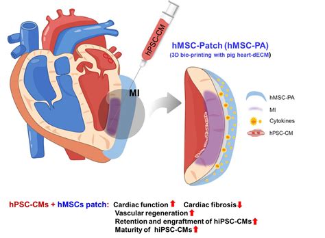 Novel dual stem cell therapy improving cardiac regeneration | Science Codex