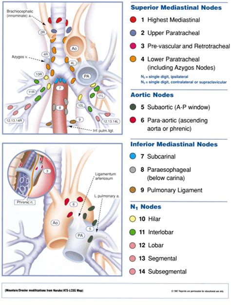 [PDF] Regional lymph node classification for lung cancer staging. | Semantic Scholar