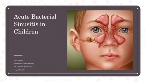 (PDF) Acute Bacterial Sinusitis in the Pediatric Patient.