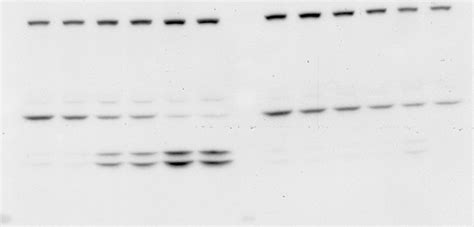 Western blotting guide: Part 5, Primary Antibodies