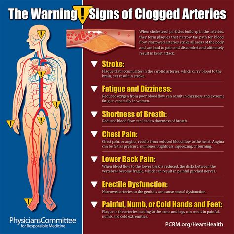 The Warning Signs of Clogged Arteries | Clogged arteries, Heart blockage, Arteries