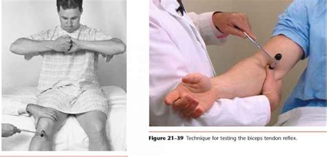 Test the Biceps Tendon Reflex - Physical Diagnosis - Mitch Medical