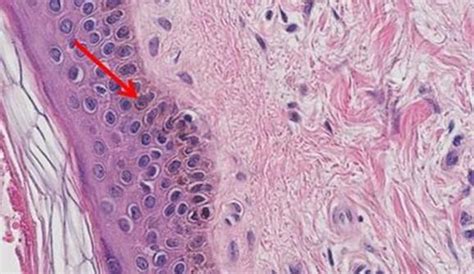 An Intro to H&E Staining: Protocol, Best Practices, Steps & More