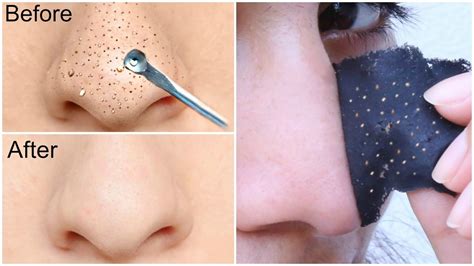 Easy DIY BLACKHEAD Remover Peel Off Mask - INSTANT RESULTS | Anaysa ...