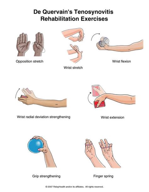 How I do treat my de Quervain's tenosynovitis? | Physical therapy exercises, Physical therapy ...