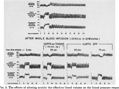 [PDF] Blood Pressure Responses to the Valsalva Maneuver in Cardiac Patients with and without ...