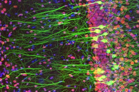 Extreme closeup of mouse-brain slice wins top Life Science Microscopy prize | Ars Technica