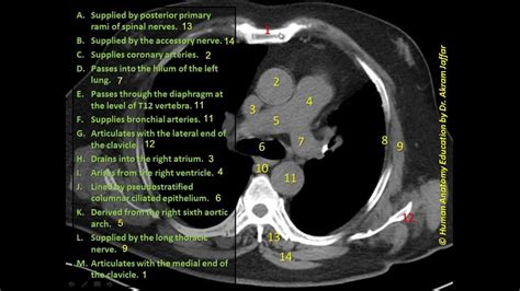 Identifying axial CT at the superior mediastinum - YouTube