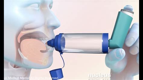 How to Use a Metered Dose Inhaler with a Spacer - YouTube