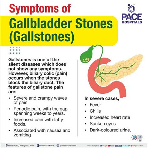 What Does The Gallbladder Do And What Causes Gallston - vrogue.co