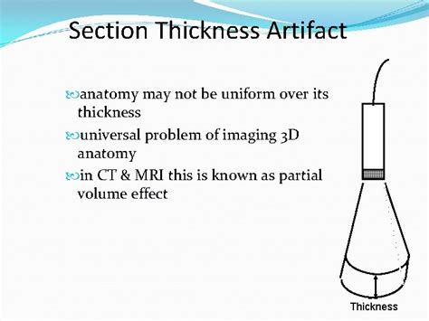 Ultrasound Physics Artifacts Hospital Physics Group George David