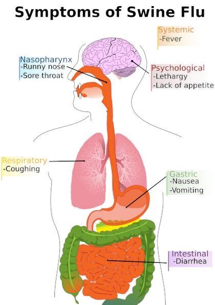 Swine Flu – Causes, Symptoms, Treatments, Complications & Precautions ...