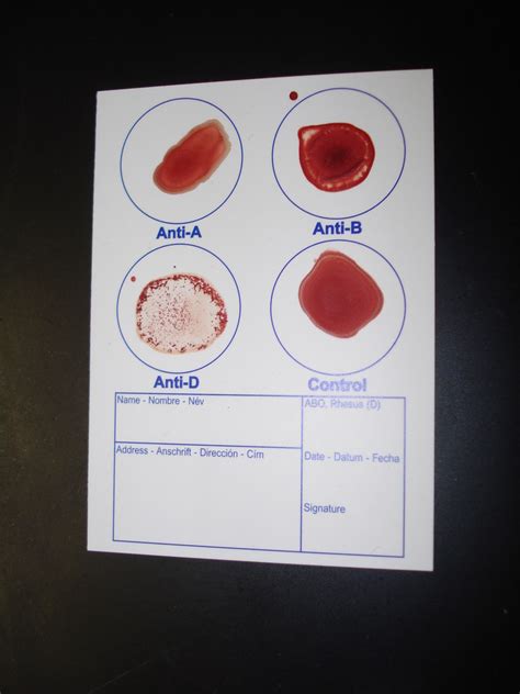 Blood Type O Positive | This was a real blood test. Blood wa… | Flickr