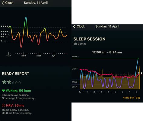 ASV settings for treatment of complex sleep apnea | Apnea Board