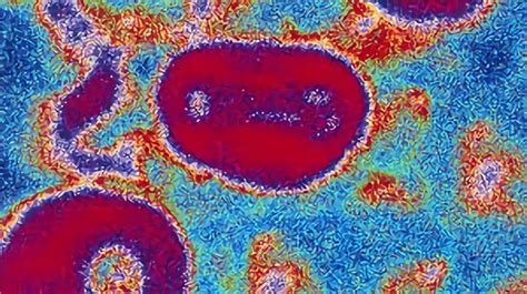 Cowpox Virus Vaccine - Creative Biolabs