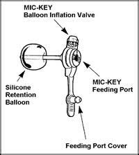 Carter & 1p36 Deletion Syndrome: Ketogenic Diet/ Mickey Button