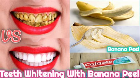 HOW TO WHITEN YOUR TEETH WITH A BANANA PEEL - YouTube