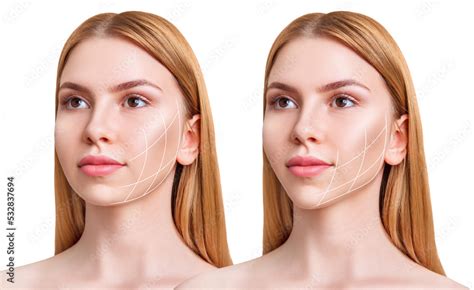 Woman before and after cheekbones shape correction. Stock Photo | Adobe ...