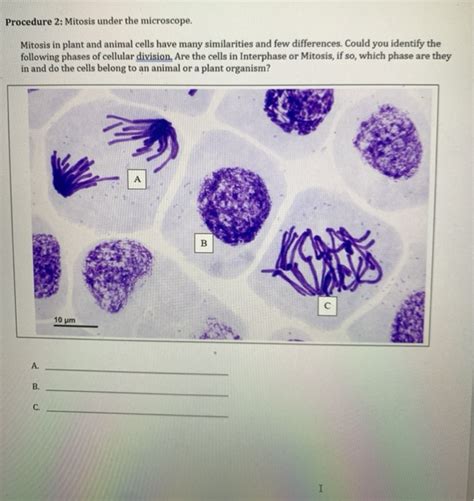 Solved Procedure 2: Mitosis under the microscope. Mitosis in | Chegg.com