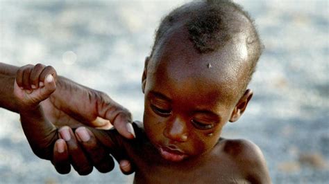 U.N. says 5 million children face acute malnutrition in Africa’s Sahel - Al Arabiya English