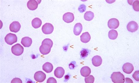 Evaluating the Bleeding Patient: Point-of-Care Tests