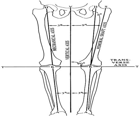 Transfemoral Amputation: Biomechanics and Surgery : Clinical Orthopaedics and Related Research®