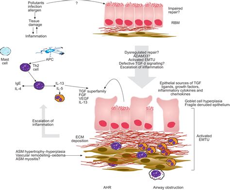 Allergen-induced airway remodelling | European Respiratory Society