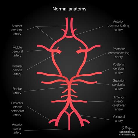 Brain Inferior View Circle Of Willis