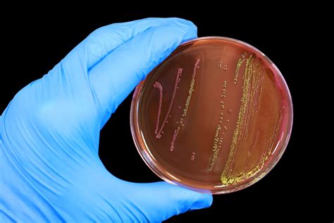 Free photo: Escherichia coli - Analysis, Microbial, Inspection - Free Download - Jooinn