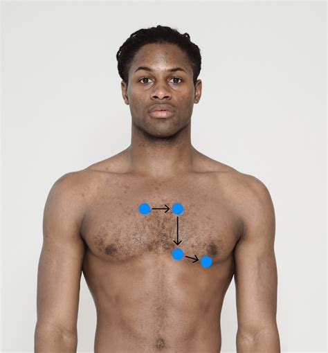 Auscultation of the Cardiac Valves – Introduction to Health Assessment ...