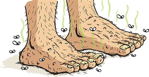 Smelly Feet (Foot Odor) | Current Health Advice, Health Blog Articles and Tips