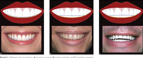 Figure 2 from 10 commandments of smile esthetics | Semantic Scholar