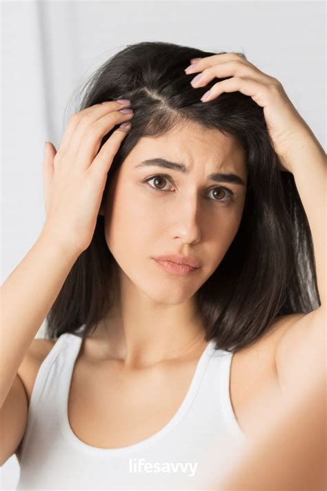 How to Get Rid of Dandruff, According to the Experts | Dandruff, Hair ...