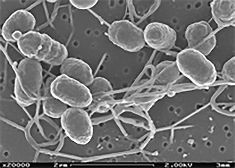 Biochemical Pathways Detoxify Hexavalent Chromium — Biological Strategy — AskNature