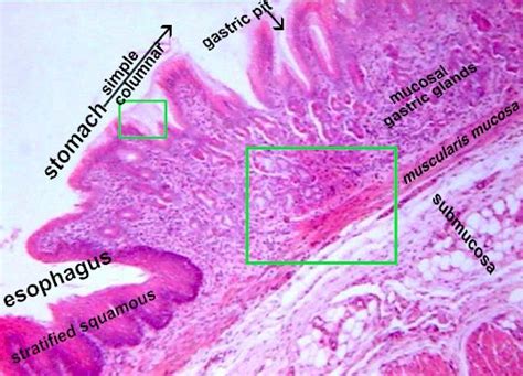 Esophagus Stomach Junction Histology Labeled 6600 | The Best Porn Website