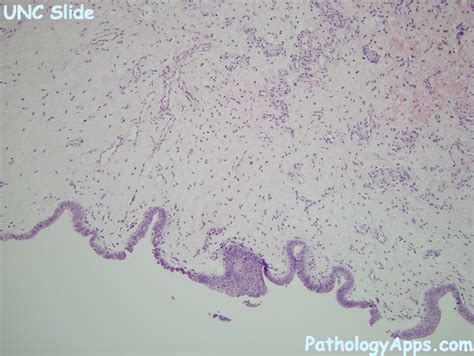 appendix testis testis histology