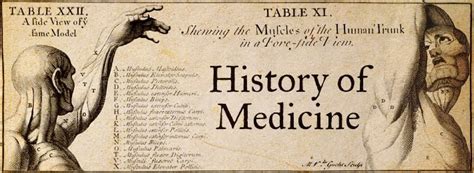 History of Medicine: Would you go to the surgeon in middle ages?