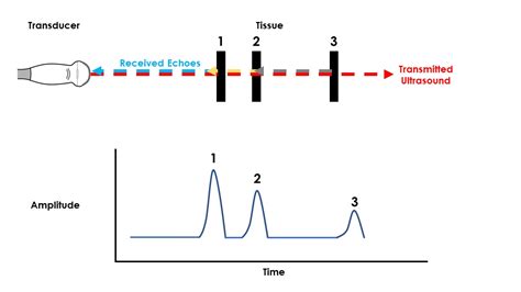 Ultrasound Modes Explained - The A, B, Ms