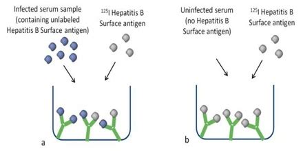 About Radioimmunoassay (RIA) - Assignment Point