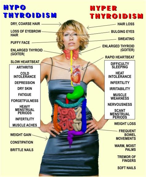 HYPOTHYROIDISM VS HYPERTHYROIDISM | THINK THYROID