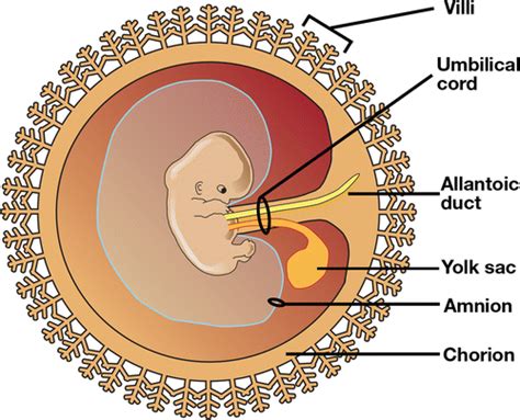 Comprehensive Imaging Review of Abnormalities of the Umbilical Cord | RadioGraphics