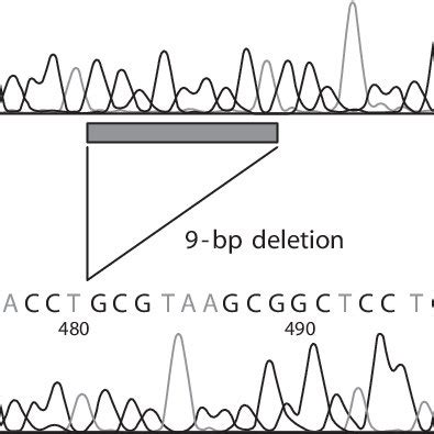 DNA sequence of the apolipoprotein (apo E) gene. The abnormal band... | Download Scientific Diagram