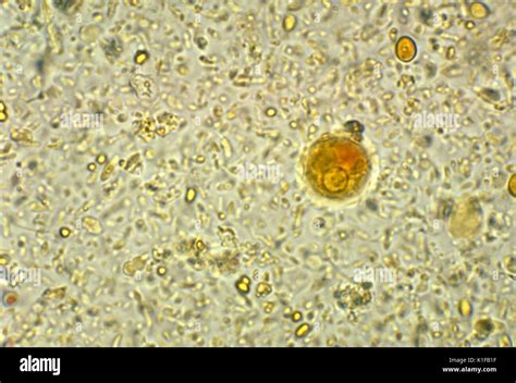 This photomicrograph depicts a cyst of an Entamoeba histolytica amoebic parasite, displaying a ...